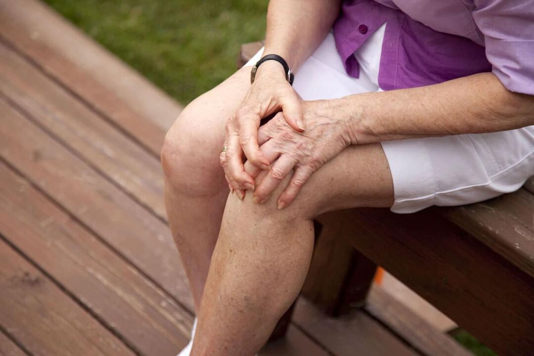 Ceļa locītavas osteoartrīts ir izplatīts gados vecākām sievietēm