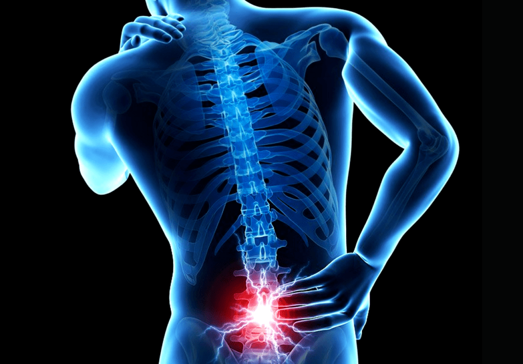 jostas daļas osteohondrozes pazīmes