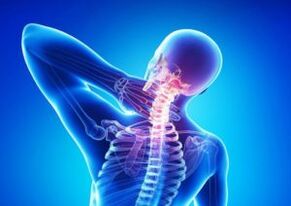 osteohondroze
